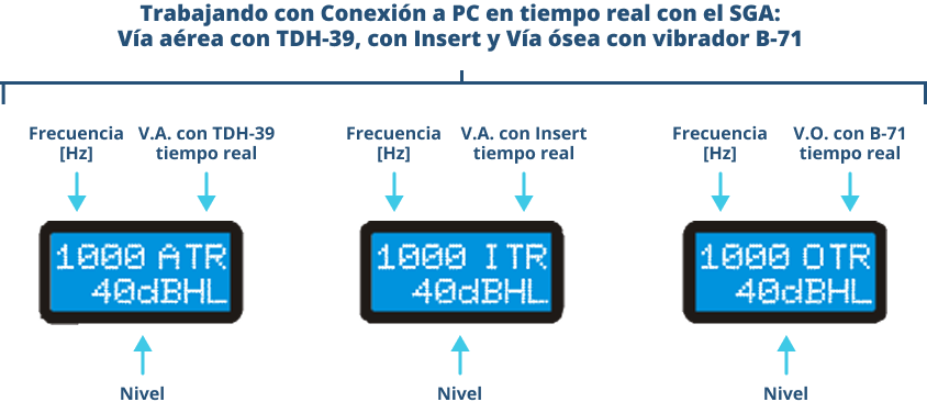 Las tres posibilidades para trabajar con bancos